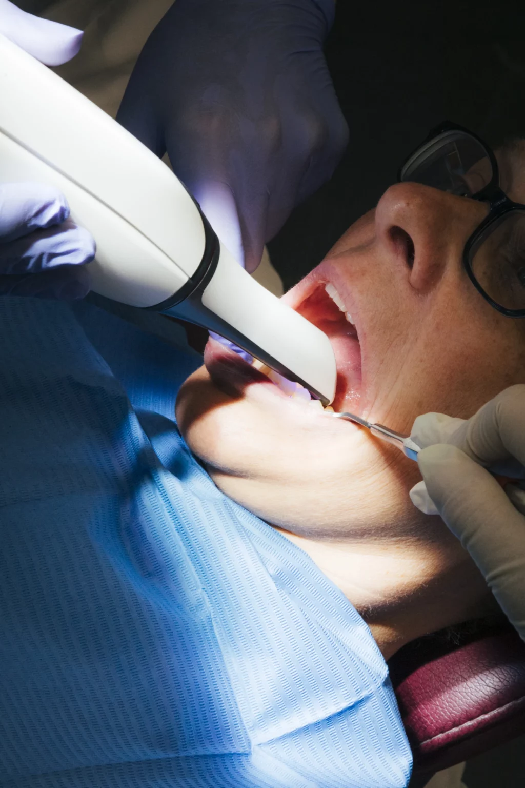 Bleaching_Zahnpraxis_Megaritis_Zug