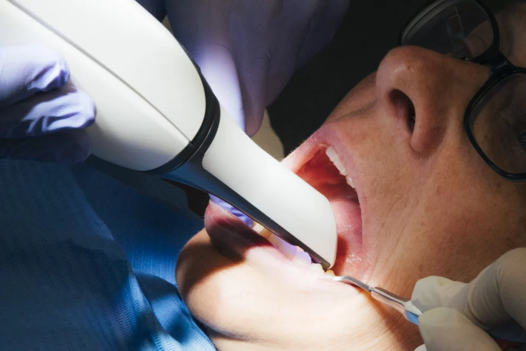 Bleaching_Zahnpraxis_Megaritis_Zug