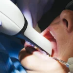 Bleaching_Zahnpraxis_Megaritis_Zug